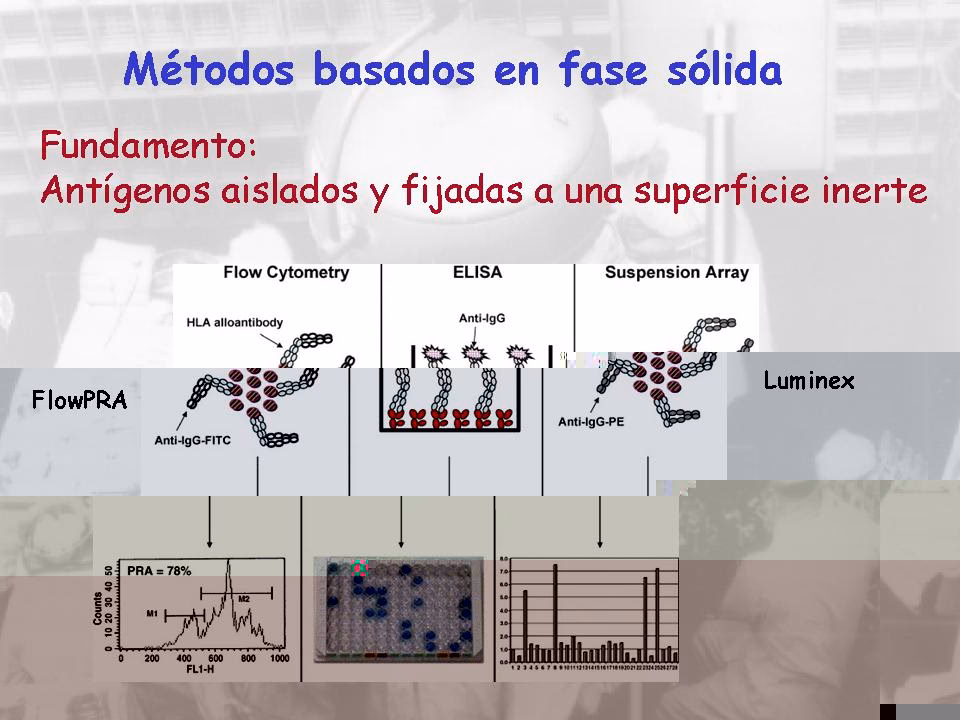 ¿Qué es la técnica de detección de anticuerpos HLA Luminex?