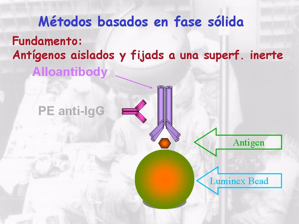Detección de Anticuerpos HLA: La Técnica Luminex